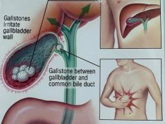 What could be the cause of stomach pain?