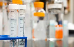 သွေး/ဆေး စစ်တဲ့အခါ ဘယ်ဟာက ဘာကိုစစ်တာလဲဆိုတာသိဖို့လိုပါ.