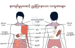 သင်ဘယ်နေရာမှာနာကျင်သလဲ ဘာကြောင့်နာကျင်ရလဲဆိုတာ ရောဂါအလိုက် ဖတ်ကြည့်သင့်ပါတယ်