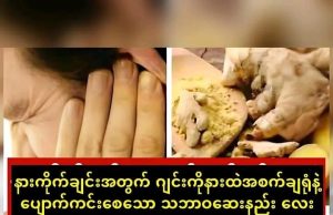 နားကိုက်တာကို ဘယ်လိုသက်သာအောင်လုပ်မလဲ
