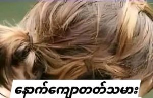 နောက်ကျောတက် ဇက်ကြောတက် လက်ပြင်ငုတ် အုံးလွဲနေသူများ