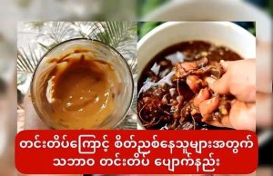 တင်းတိပ်ကြောင့် စိတ်ညစ်နေသူများအတွက် သဘာဝ တင်းတိပ် ပျောက်နည်း