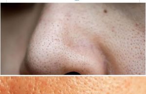 မျက်နှာ ချွေးပေါက်တွေကို ဘယ်လိုကာကွယ်မလဲ