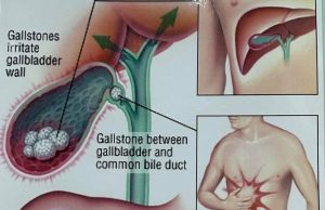 What could be the cause of stomach pain?