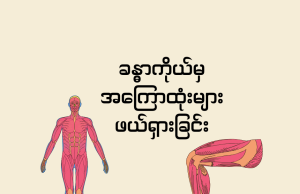 ခန္ဓာကိုယ်မှ အကြောထုံးများ ဖယ်ရှားခြင်း