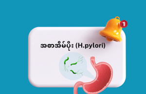 အစာအိမ်ပိုး (H.pylori)